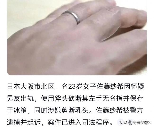 日本女子切掉男友无名指