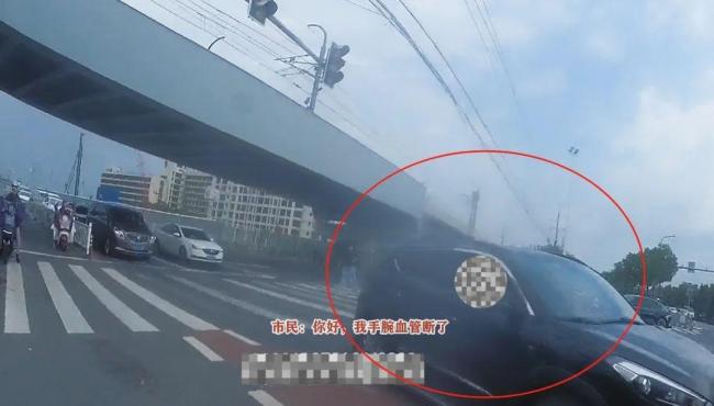 男子手筋断裂 民警开道送医