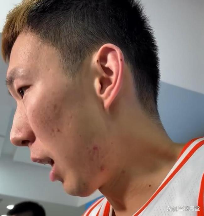 周琦：腰伤恢复得不错