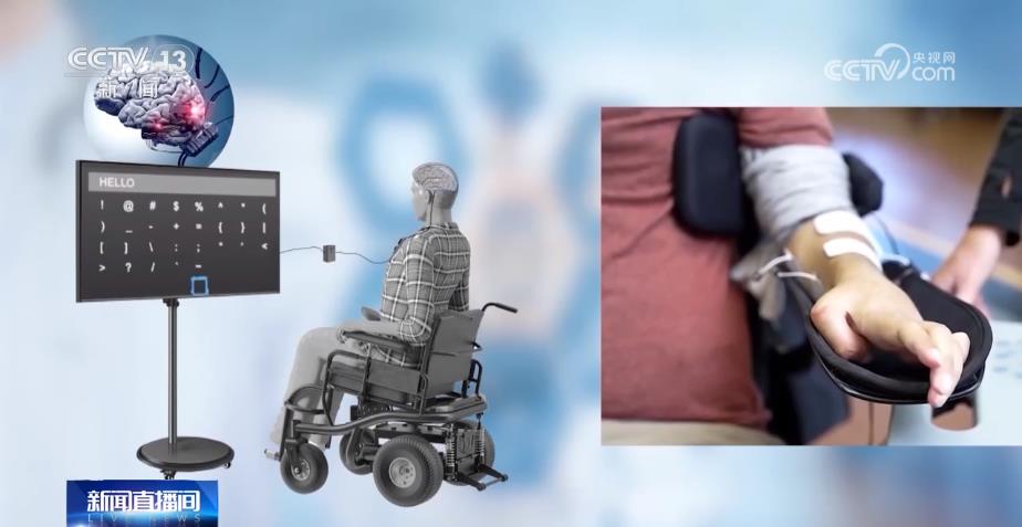 我国脑机接口技术走向临床 受试者体验如何？