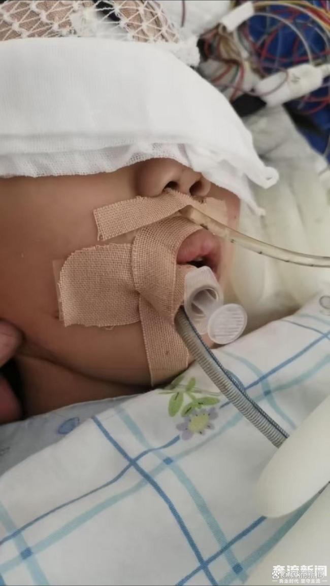 女童术后成植物人 医护人员篡改病历