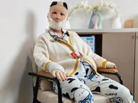 被前男友泼汽油烧伤女孩发声 希望网友停止网暴