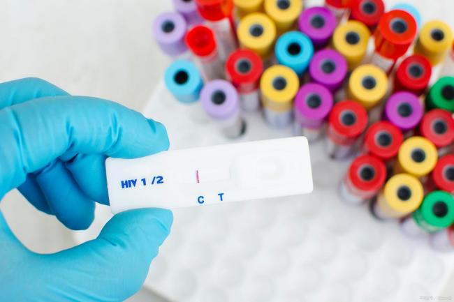 大三男生网络交友3个月感染艾滋病