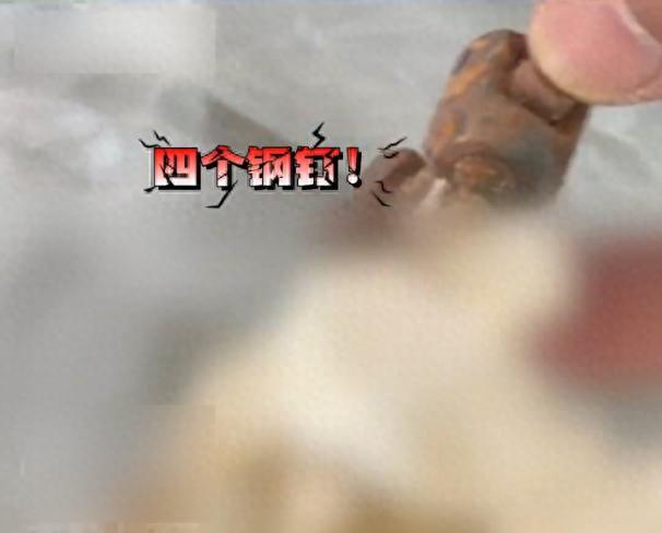 老人骨灰现4颗手术钢钉 家属质疑