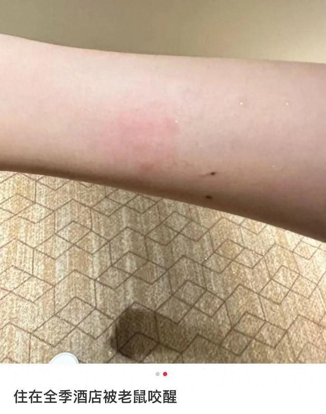 全季酒店回应女子半夜被老鼠咬醒
