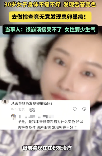 30岁女子舌苔变色意外查出卵巢癌