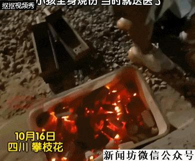 男童掉进炭火堆母亲徒手救出