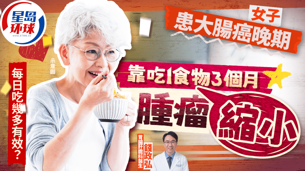 女子患大肠癌晚期 女子患大肠癌晚期