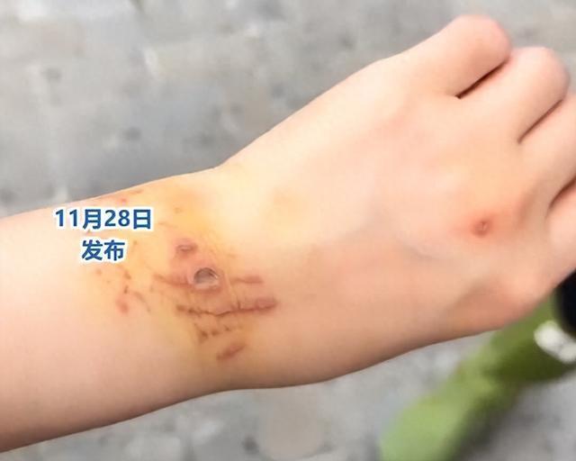 女子回应生理期潜水被鲨鱼咬伤