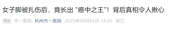 女子脚被扎伤后竟长出 “癌中之王”!医生提醒
