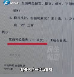 郑州小伙暴走后突然嘴歪眼斜