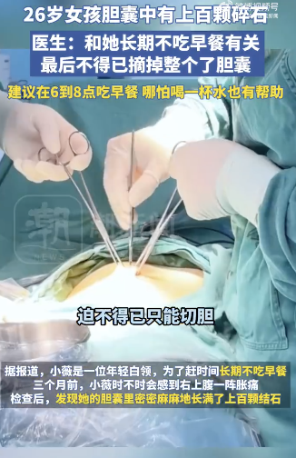 26岁女孩不吃早饭胆囊长满碎石