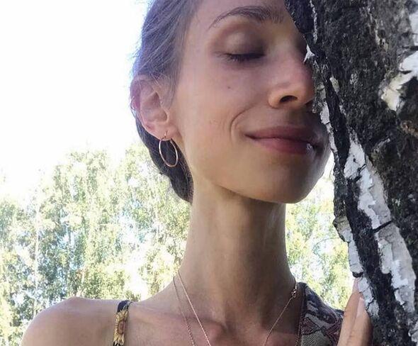 27岁女子只吃水果身亡 体重仅22公斤