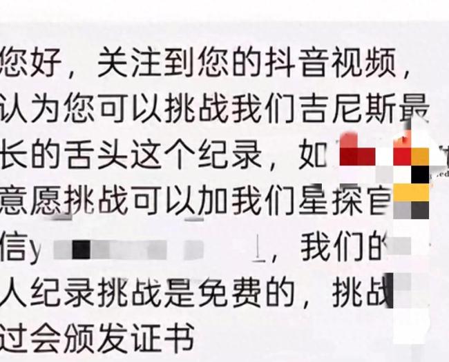 河北一男子舌头长13厘米