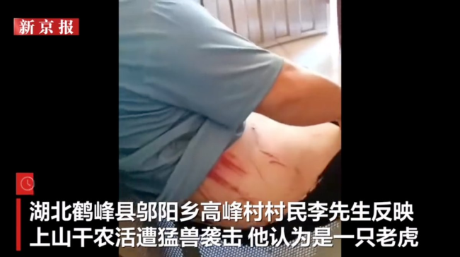 湖北村民干农活时遭疑似豹子袭击