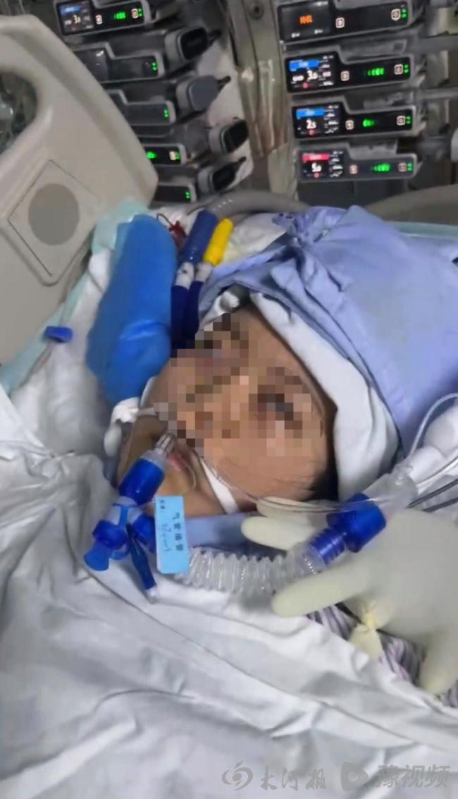 22岁女子手术成功却脑死亡