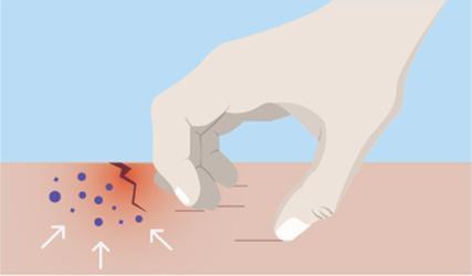 华人科学家揭秘人体为何会痒