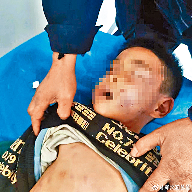 涵涵被打至满身伤痕,最终伤重死亡。 微博 涵涵被打至满身伤痕,最终伤重死亡。 微博