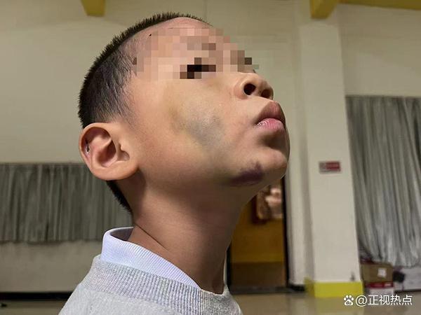 女子称儿子遭生父继母虐待