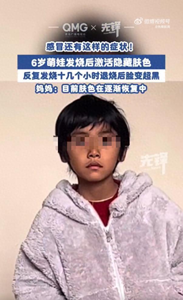 6岁男孩发烧后竟然“变色”了：警惕肝脏损伤信号