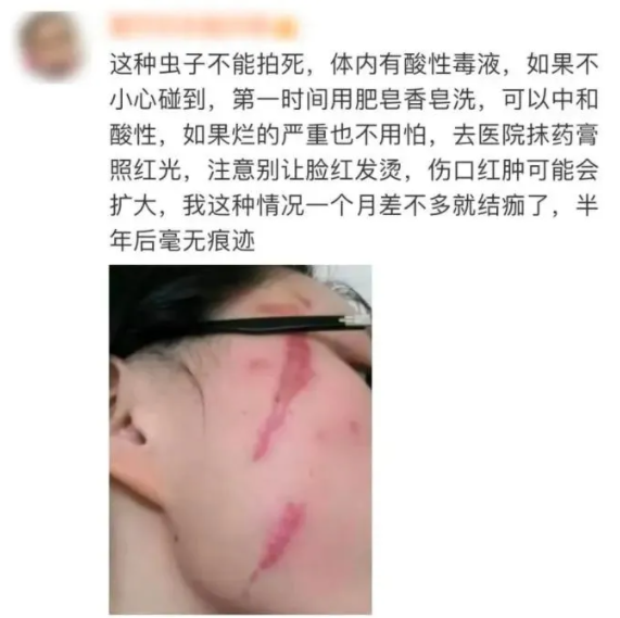 毒液堪比硫酸 一地确诊200多例!防护指南来了