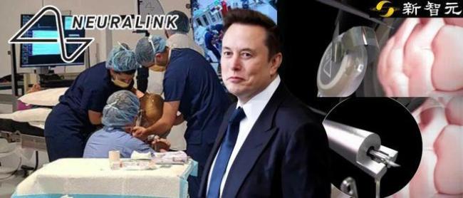 马斯克“开颅插针”首破1.5秒