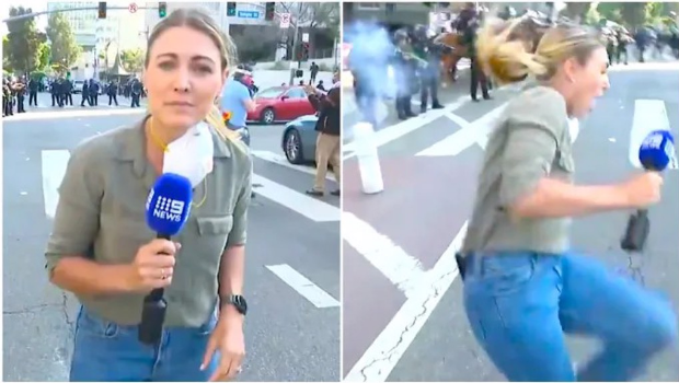 澳洲记者托马西在连线报导洛杉矶暴乱时,被后方的镇暴警察开了一枪,橡皮子弹击中她的腿。 澳洲记者托马西在连线报导洛杉矶暴乱时,被后方的镇暴警察开了一枪,橡皮子弹击中她的腿。