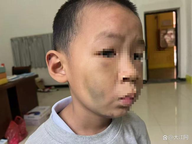 7岁男童遭长期殴打生父被拘