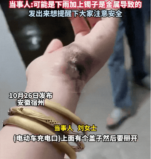 一瞬间手被烧黑 只因忽视这个充电细节！