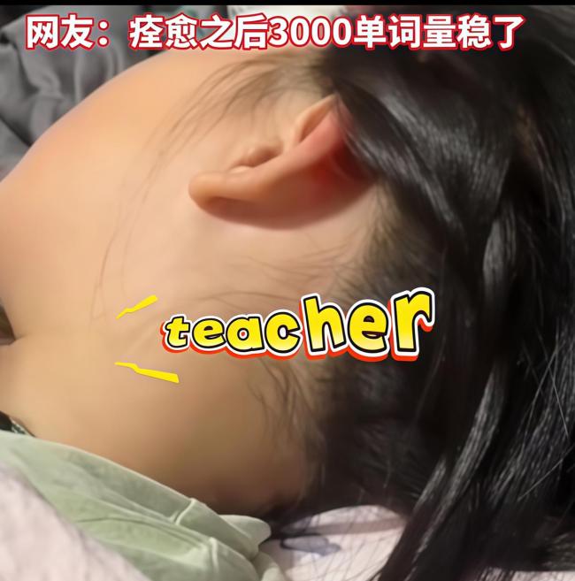 女孩甲流高烧睡梦中狂背单词