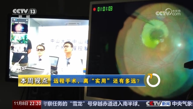 远程手术离“实用”还有多远
