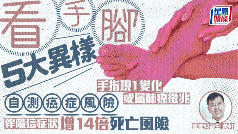 示意图 示意图