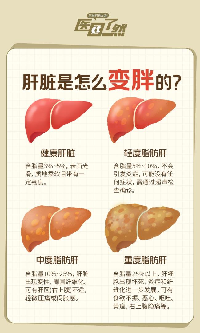 脂肪肝超过这个程度就危险了