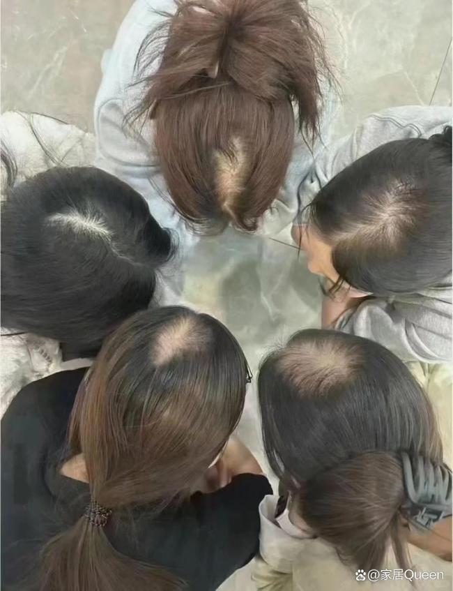 女子用硫磺皂洗头，坚持1个月后，困扰多年的问题解决了