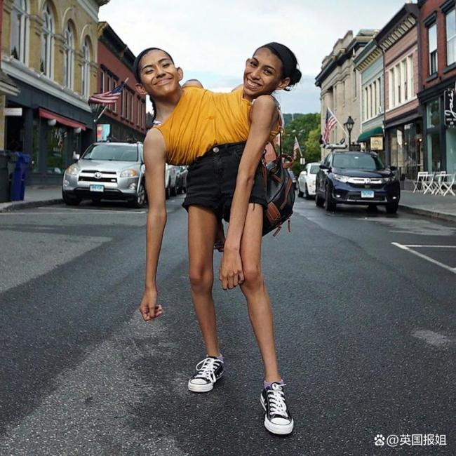 连体人姐姐要结婚妹妹要单身