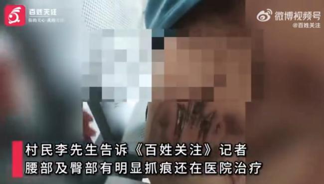 村民称干农活时被老虎抓伤