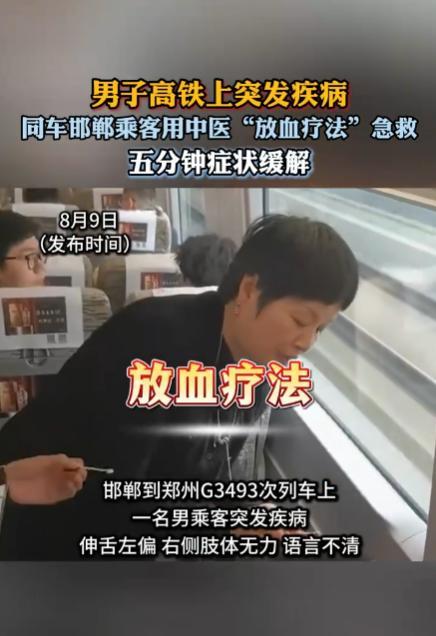 男子高铁发病乘客用放血疗法急救